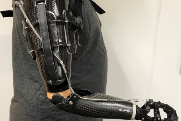 Powered Prostheses