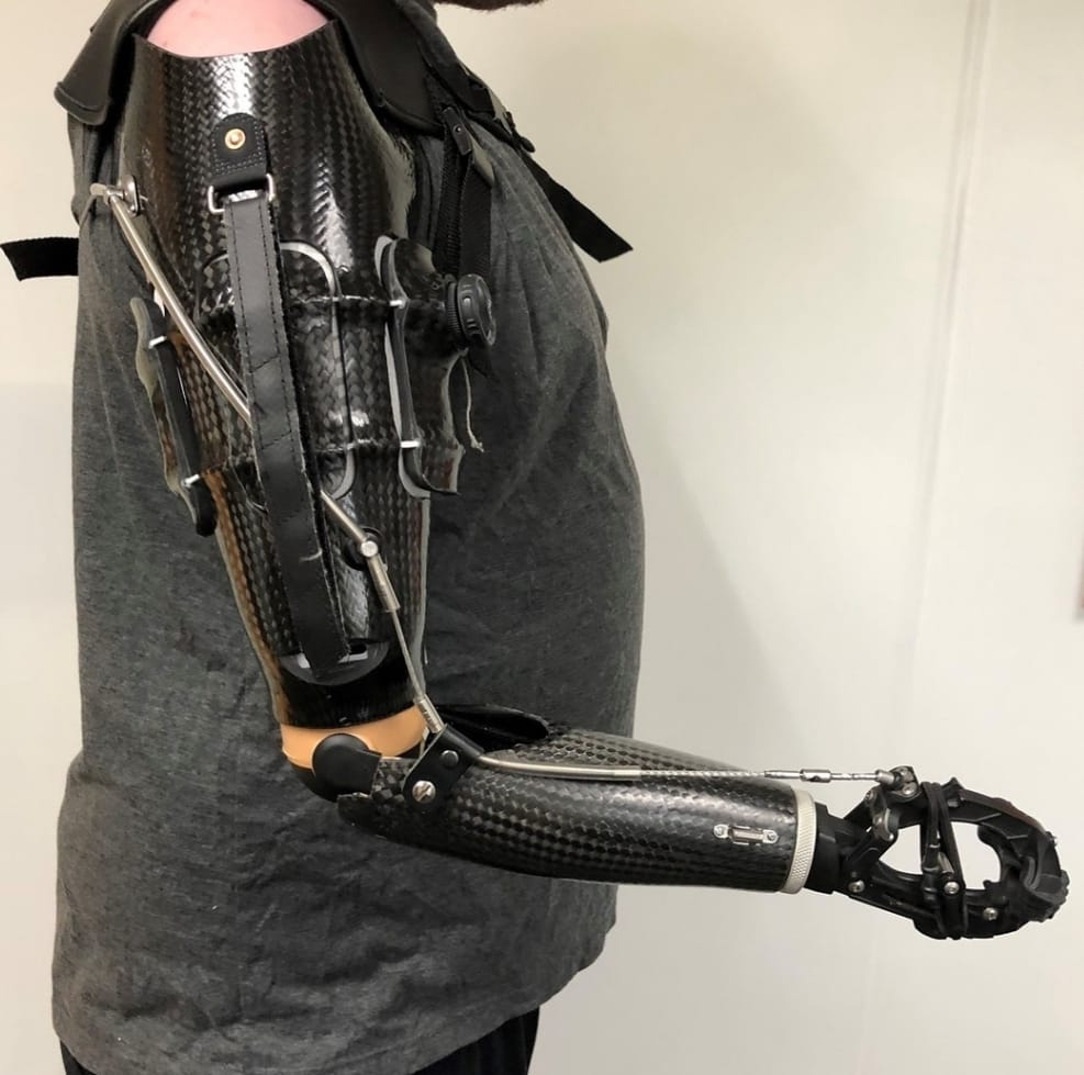 Powered Prostheses